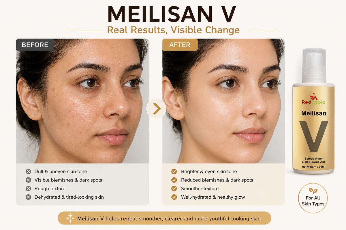 Meilisan V Anti-Aging Skincare, 30ml