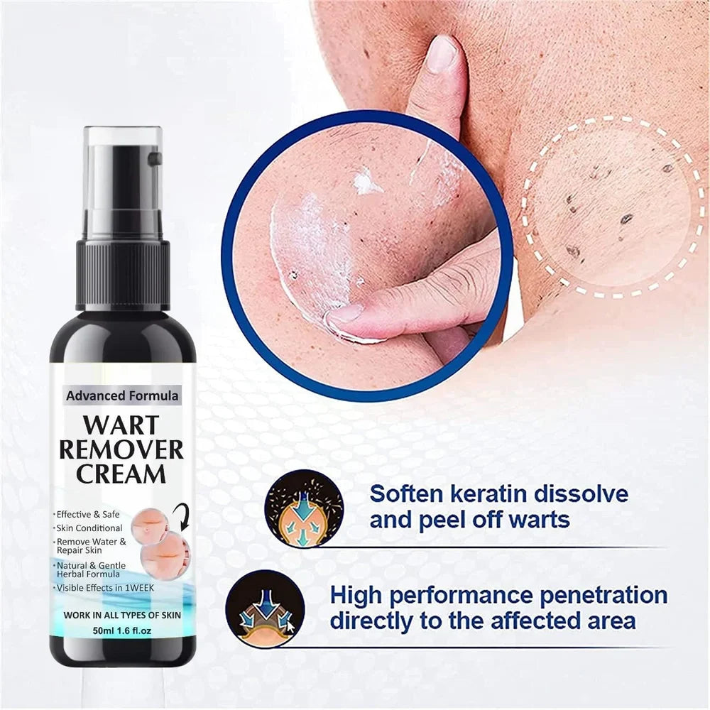 Wart Remover Cream - Pack of 2 Topical Treatment for Hands and Feet