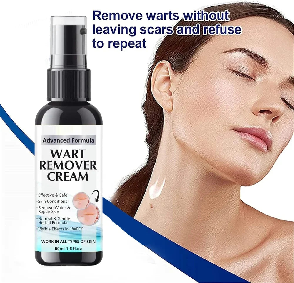 Wart Remover Cream - Pack of 2 Topical Treatment for Hands and Feet