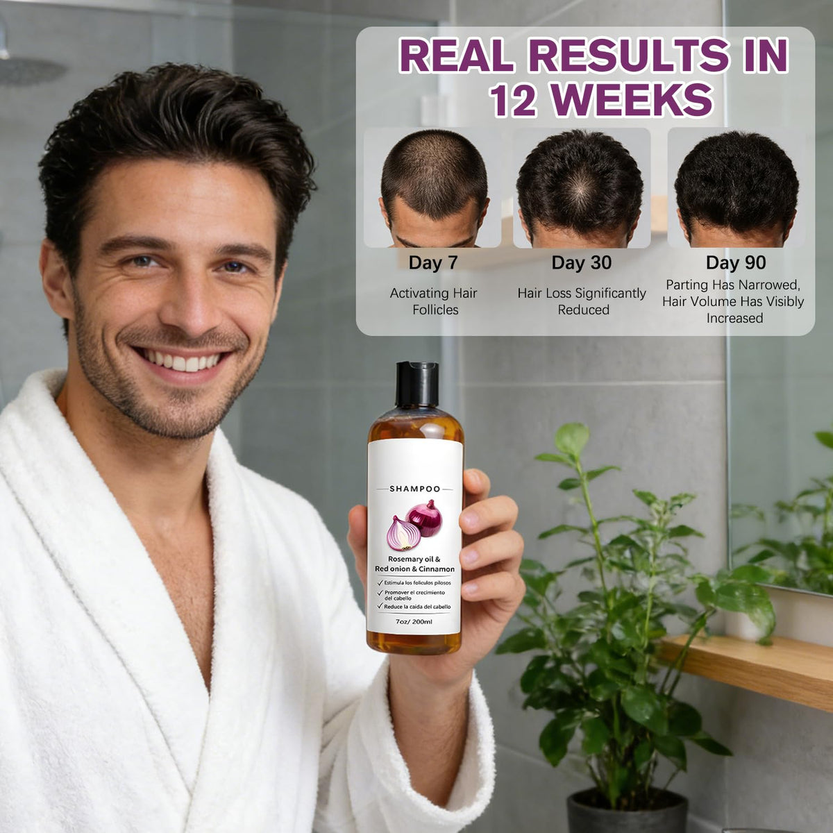 Shampoo De Cebolla with Rosemary Oil, Red Onion & Cinnamon Extract
