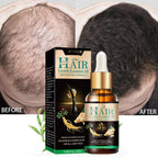 Two 30ml bottles of hair growth serum against a clean background.