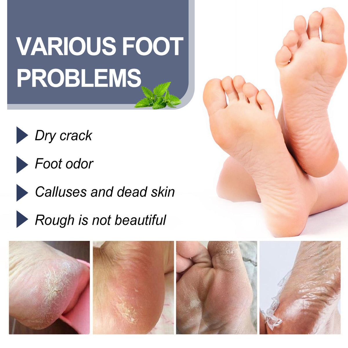 Anti-Fungal Odor Removal Natural Foot Deodorant Spray