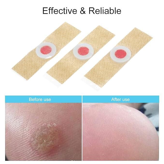 Corn Remover Pads - Pack of 2 (Total 48 Pads)