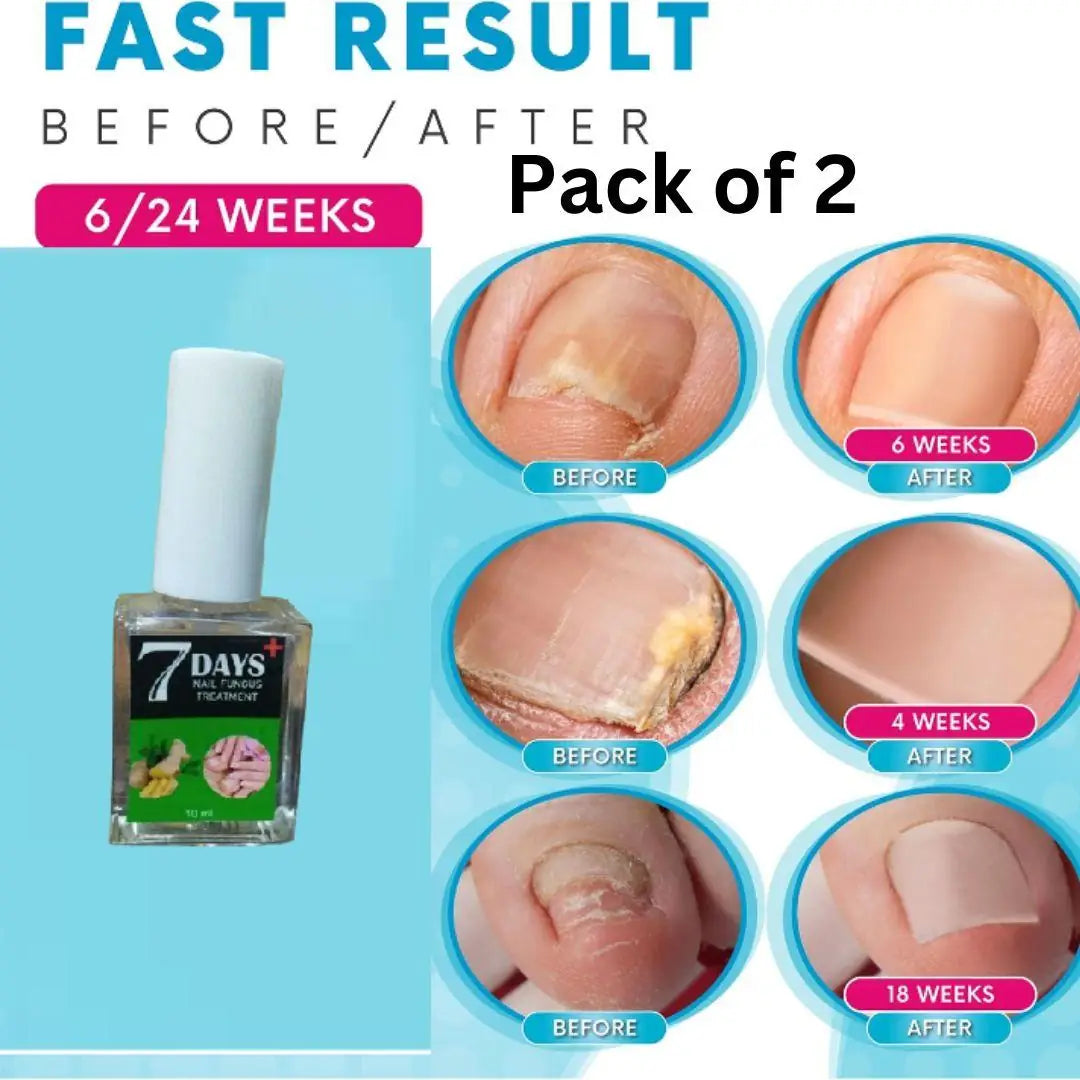 Two bottles of natural nail fungus repair polish side by side
