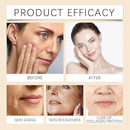 Botox Cream - 20g (Pack of 2)