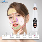 Advanced Blackhead & Whitehead Remover, 6 Suction Heads, abs plastic