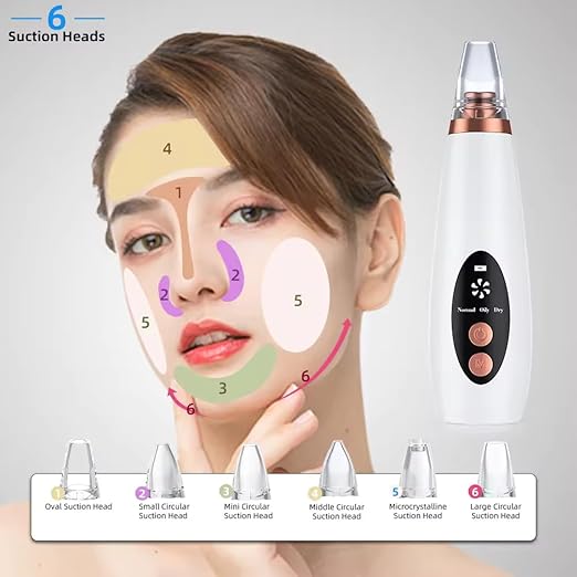 Advanced Blackhead & Whitehead Remover, 6 Suction Heads, abs plastic