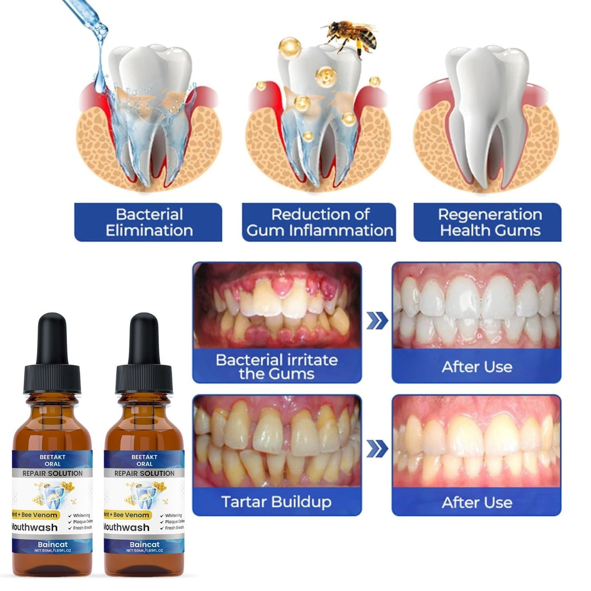 Dental Treatment Drops 50ml - Pack of 2