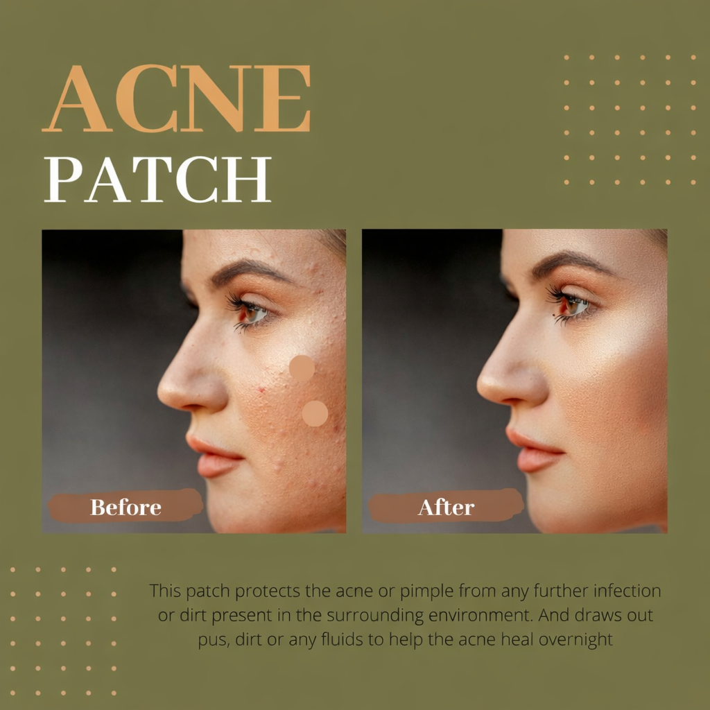 Acne Pimple Patch, Pack of 20