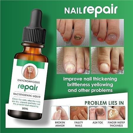 Nail Repair Serum, 30ML (Pack of 2), 30 ml