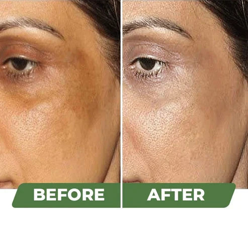 Skin Brightening Cream