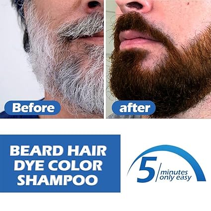 Men's Hair, Mustache & Beard Dye, Natural Black Color in 5 Minutes, 120ml