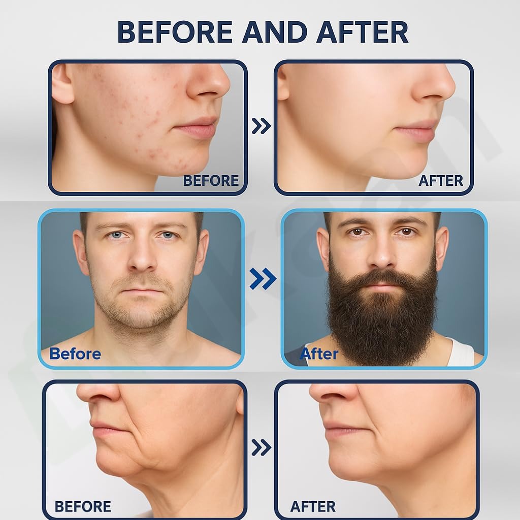 Derma Stamp for Hair & Beard Regrowth