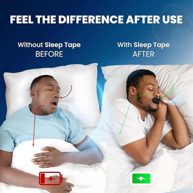 Anti-Snore Mouth Tape - Sleep Aid Patches (30 Count)