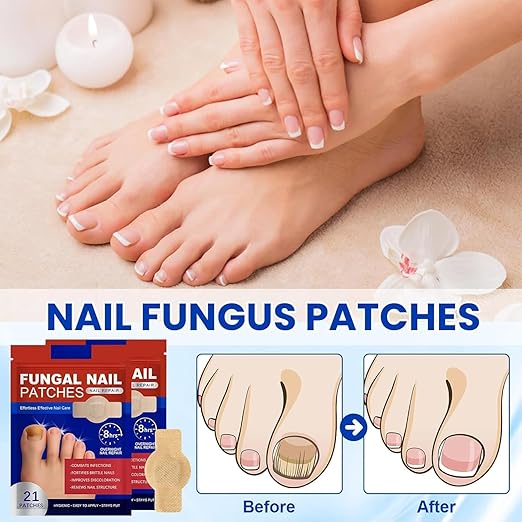 Toenail & Fingernail Fungal Nail Patches, 21 Pcs