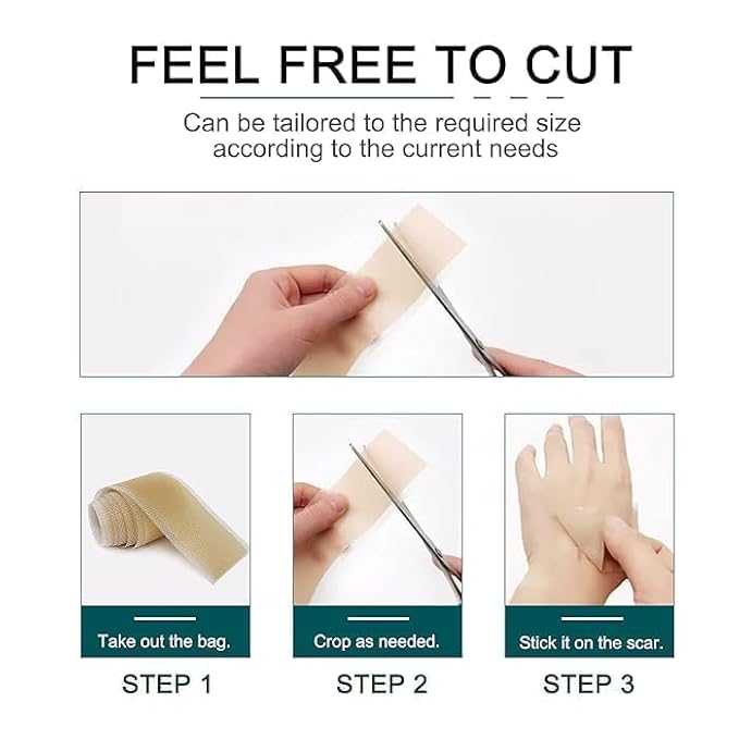 Silicone Scar Tape Roll - Adhesive Skin Management Strip