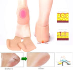 Heel Pain Relief Silicone Gel Heel Protector Socks - 1 Pair