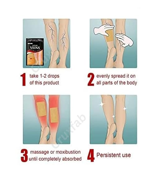 Varicose Veins Health Care Spray with Natural Herbal Formula