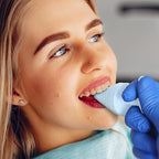 High-quality plastic emergency mouth opener for clinical use