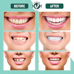 Teeth Denture Set - Pack of 3