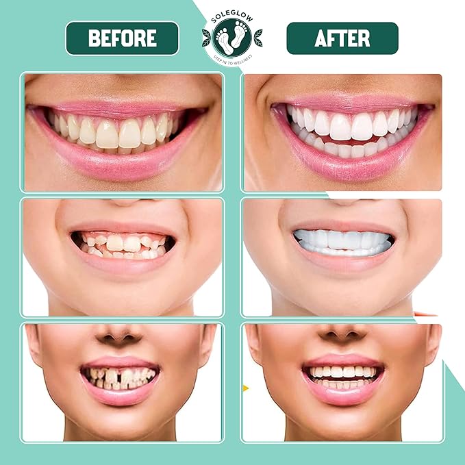 Teeth Denture Set - Pack of 3